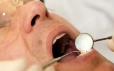 3 Signs Your Wisdom Teeth Need To Go
