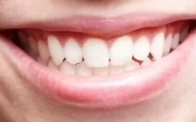 Four Types of Teeth