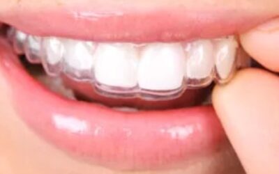 The Clear Leader in Teeth-Straightening Solutions