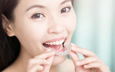 Providing Answers to Your Invisalign Questions