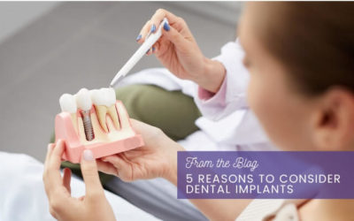 5 Reasons to Consider Dental Implants