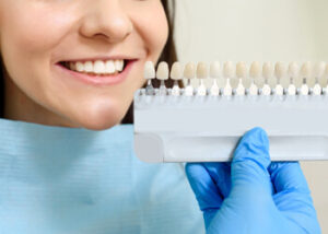 maintain look teeth veneers chatswood