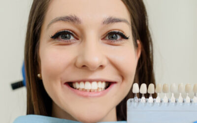 Composite Veneers vs Porcelain Veneers – Which Should You Choose?