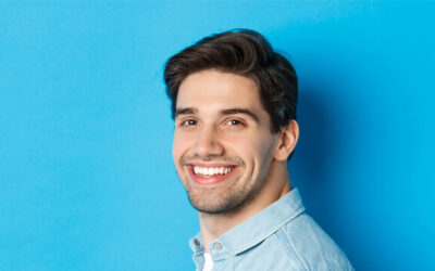 Veneers Before And After — Preparation And Results