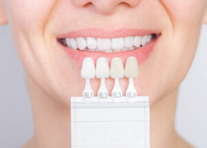 tooth veneers disadvantages chatswood