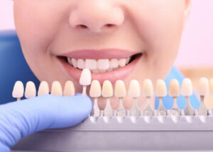 veneer dental drawbacks chatswood