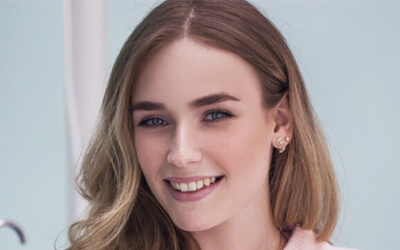 Do You Need Straight Teeth for Veneers? All You Need to Know
