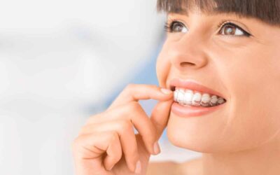 Do Clear Aligners Work? An In-Depth Look into the Benefits and Drawbacks of Teeth Straightening