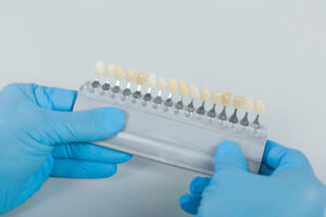 costs for fixing gaps tooth veneers