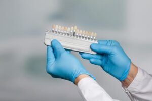 extending lifespan veneers