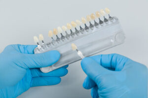 potential risks involved veneers