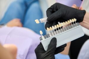 veneers right candidate chatswood