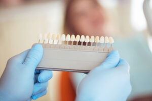 veneer dentist treatment process chatswood