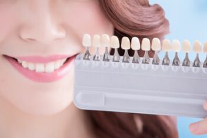 comparison teeth veneer crown