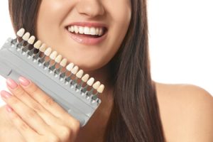 cost compare tooth crowns veneer