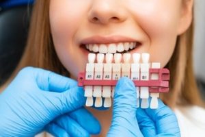 veneers cost turkey application