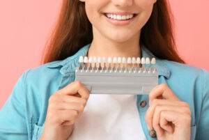 Veneers For Front Teeth colour