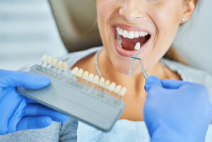 teeth veneers cost australia colour