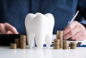 What Are composite Veneers cost chatswood