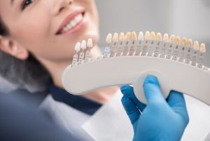 porcelain veneers cost australia colour chatswood