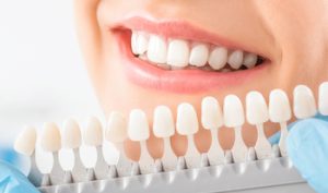 advantages of porcelain veneers chatswood