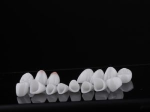 difference of porcelain veneers chatswood