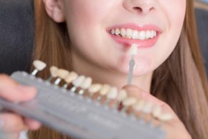 duration to get veneers chatswood