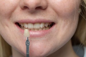procedure to get veneers chatswood