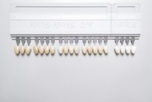 Affordable Dental Veneers colour chatswood
