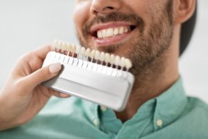 Lumineers Vs Veneers colour chatswood