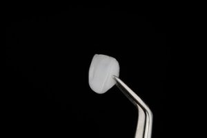 affordable dental veneers shells chatswood