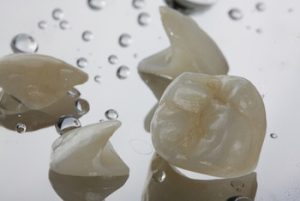 Can Veneers Be Removed shells