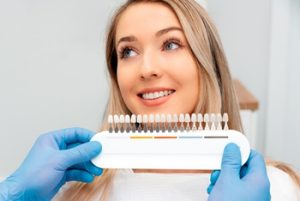 Do Veneers Need To Be Replaced colour