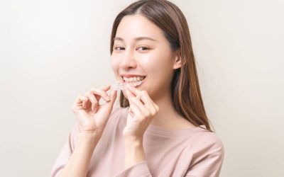 Planning Your Budget: How Much Does Invisalign Cost?