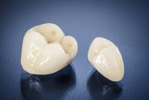 tooth cap vs crown shell