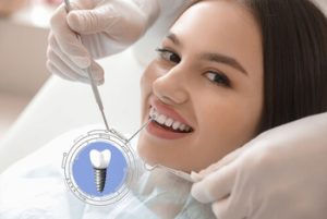 Can You Get a Temporary Tooth While Waiting for an Implant check