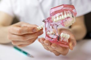 Can You Get a Temporary Tooth While Waiting for an Implant planning