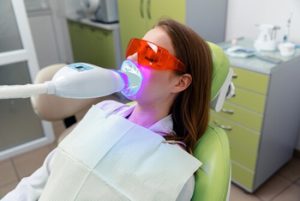 How Long Will My Teeth Hurt After Whitening professional