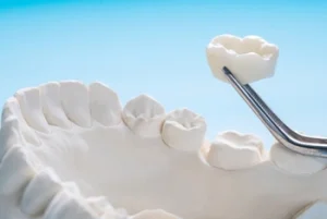 Tooth Crown Pain replacement