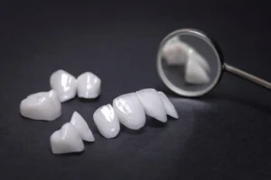 veneer shells lined up with a dental mirror