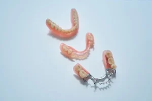 Implant Supported Dentures types