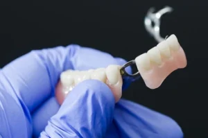 Loose Dentures in Elderly fit