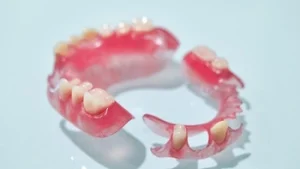 What Is a Partial Denture set