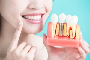 truth about dental implant cost illustration