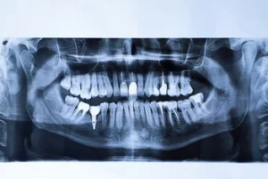 x ray imaging