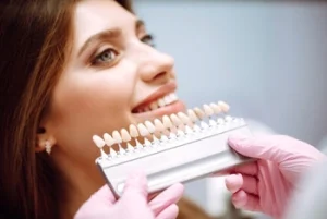 Porcelain Veneers Before and After right colour