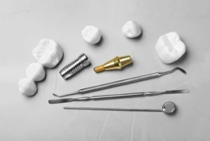 Mouth Dental Implants Cost quality