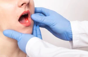 Types Of Dental Abscess pain Types Of Dental Abscess pain