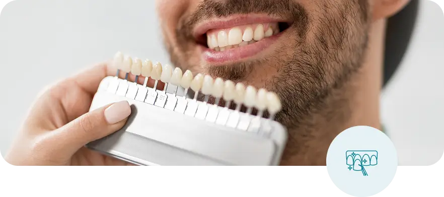 Dental shade guide used for professional teeth whitening