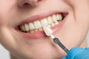 Full Set Of Veneers Cost aesthetics chatswood
